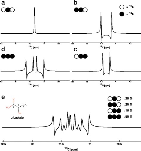(13)C glucose labelling studies using 2D NMR are a useful tool for determining ex vivo whole organ metabolism during hypothermic machine perfusion of kidneys.