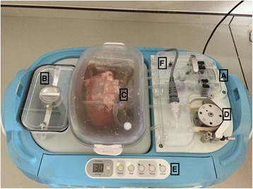 (13)C glucose labelling studies using 2D NMR are a useful tool for determining ex vivo whole organ metabolism during hypothermic machine perfusion of kidneys.
