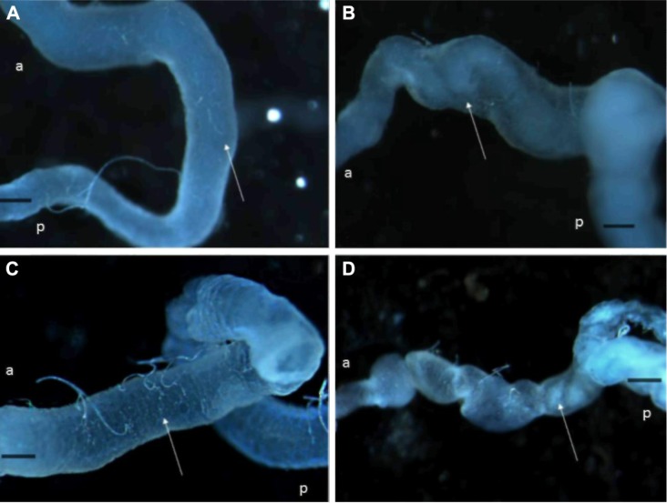 Plant Defense Inhibitors Affect the Structures of Midgut Cells in Drosophila melanogaster and Callosobruchus maculatus.