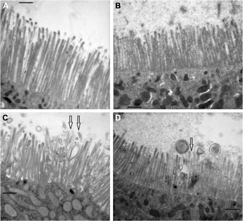 Plant Defense Inhibitors Affect the Structures of Midgut Cells in Drosophila melanogaster and Callosobruchus maculatus.