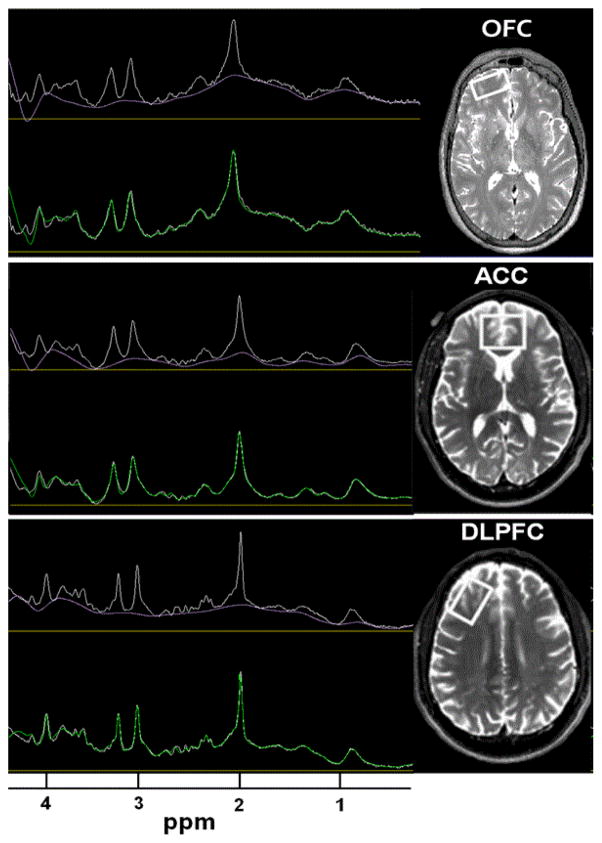 Frontal Metabolite Concentration Deficits in Opiate Dependence Relate to Substance Use, Cognition, and Self-Regulation.
