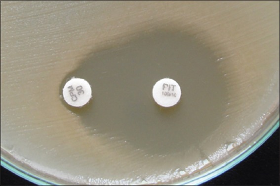 Phenotypic Detection and Antibiogram of β-lactamase-producing <i>Proteus</i> Species in a Tertiary Care Hospital, India.