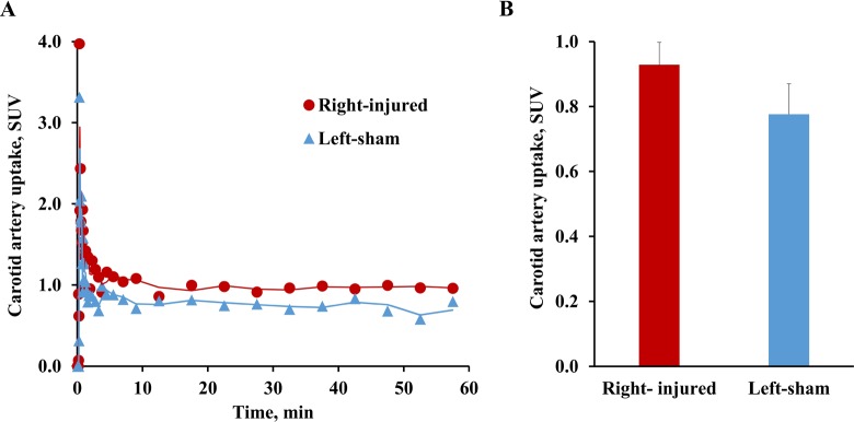 PET Study of Sphingosine-1-Phosphate Receptor 1 Expression in Response to Vascular Inflammation in a Rat Model of Carotid Injury.