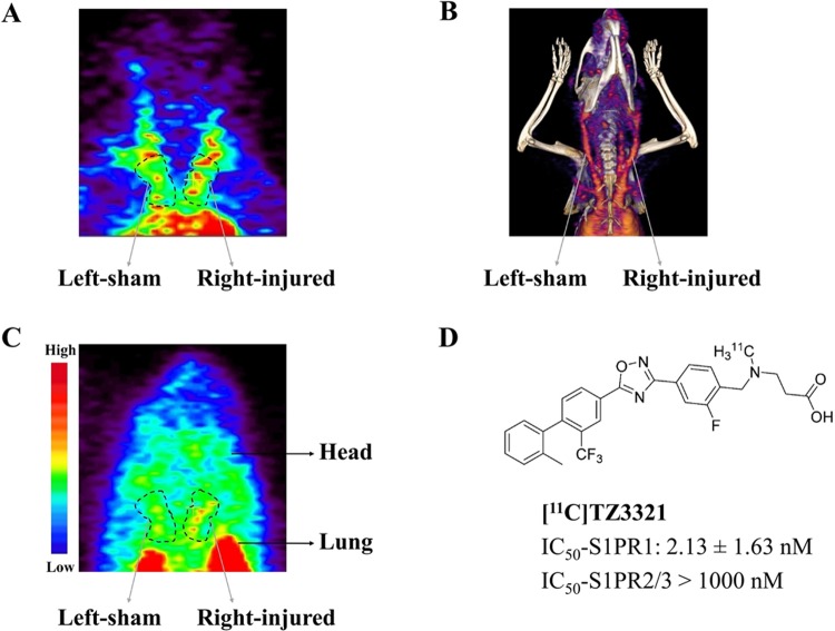 PET Study of Sphingosine-1-Phosphate Receptor 1 Expression in Response to Vascular Inflammation in a Rat Model of Carotid Injury.