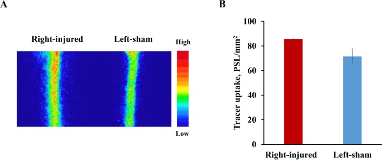 PET Study of Sphingosine-1-Phosphate Receptor 1 Expression in Response to Vascular Inflammation in a Rat Model of Carotid Injury.