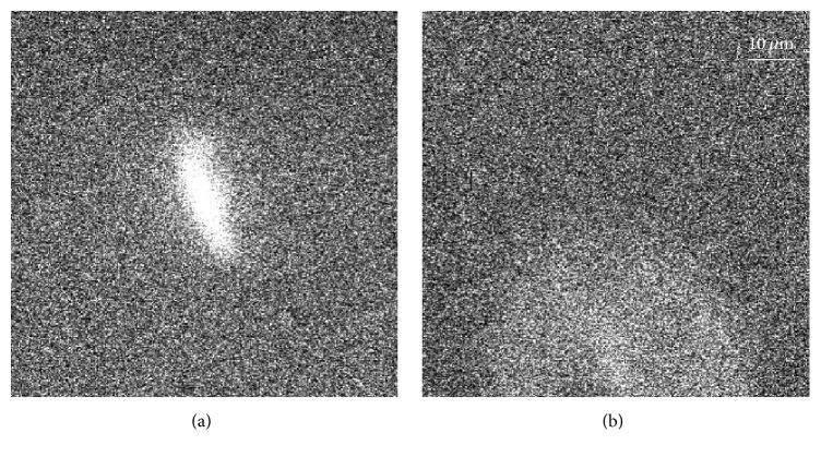 Space and Time Resolved Detection of Platelet Activation and von Willebrand Factor Conformational Changes in Deep Suspensions.