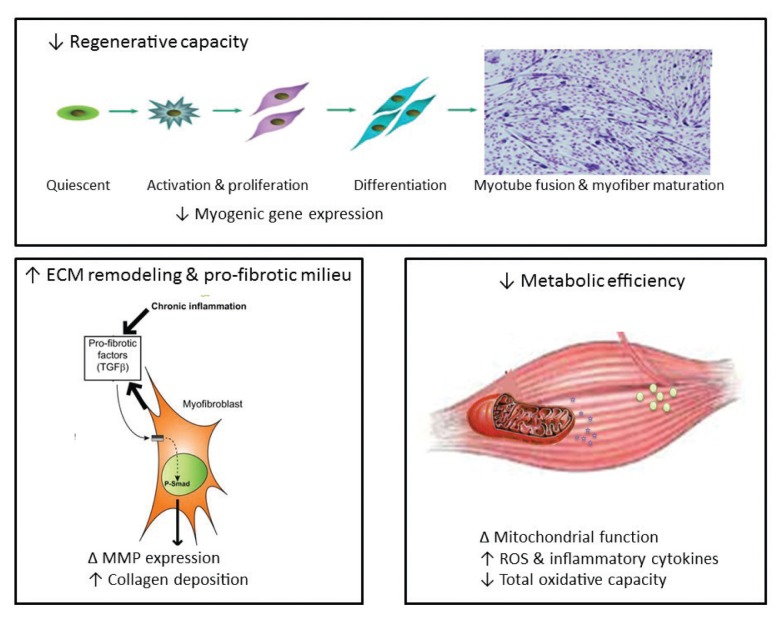 Alcoholic Myopathy: Pathophysiologic Mechanisms and Clinical Implications.