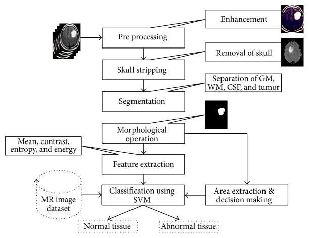 Image Analysis for MRI Based Brain Tumor Detection and Feature Extraction Using Biologically Inspired BWT and SVM.