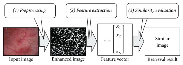 Image Retrieval Method for Multiscale Objects from Optical Colonoscopy Images.