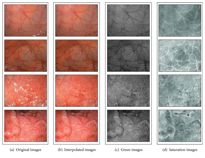 Image Retrieval Method for Multiscale Objects from Optical Colonoscopy Images.