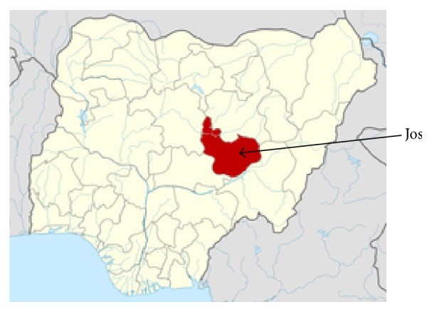 Patient Experiences of Decentralized HIV Treatment and Care in Plateau State, North Central Nigeria: A Qualitative Study.