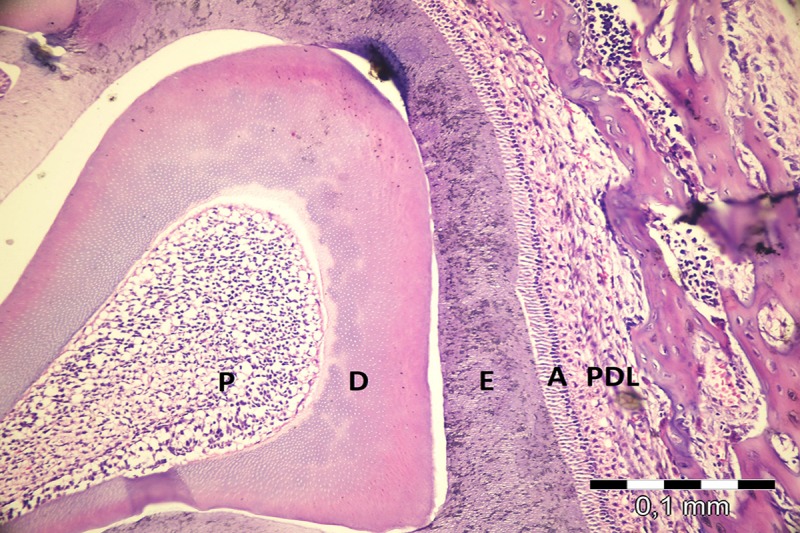 Effects of pamidronate administration on tooth eruption and mandibular growth in new born rats.