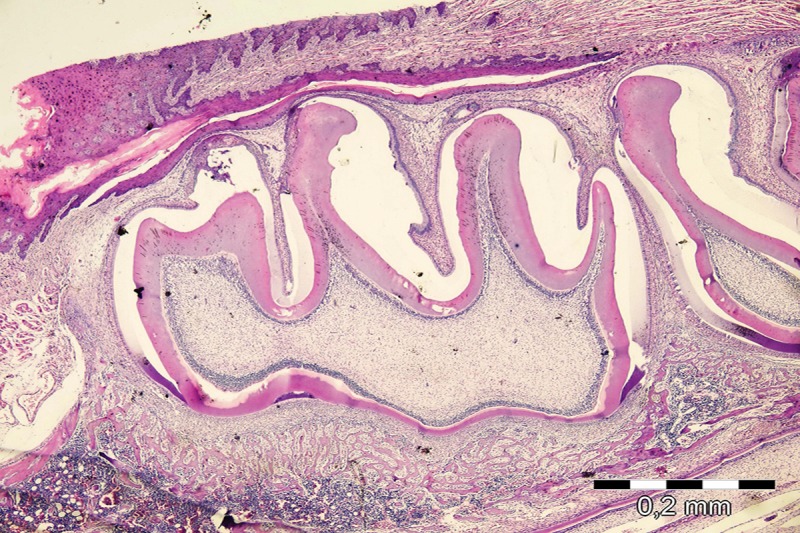 Effects of pamidronate administration on tooth eruption and mandibular growth in new born rats.