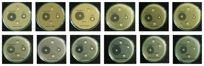 Antibacterial Activity of Free Fatty Acids from Hydrolyzed Virgin Coconut Oil Using Lipase from <i>Candida rugosa</i>.