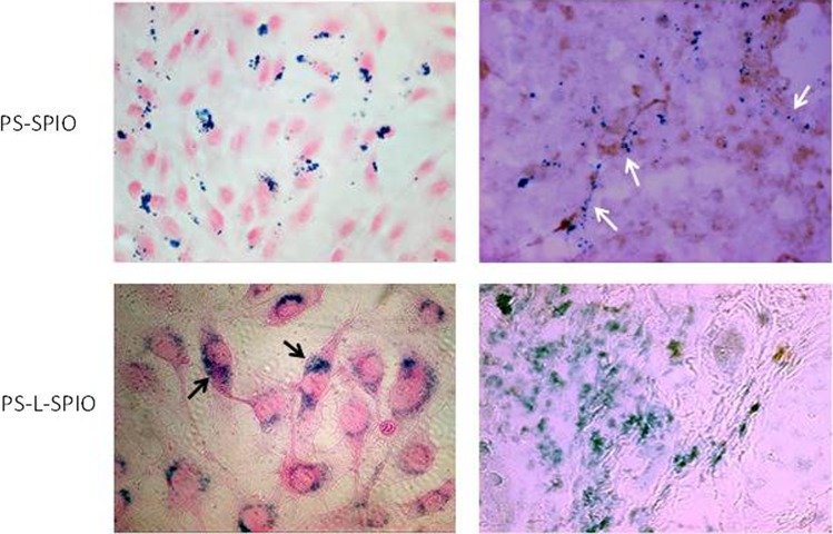 Phosphatidylserine-Targeted Nanotheranostics for Brain Tumor Imaging and Therapeutic Potential.