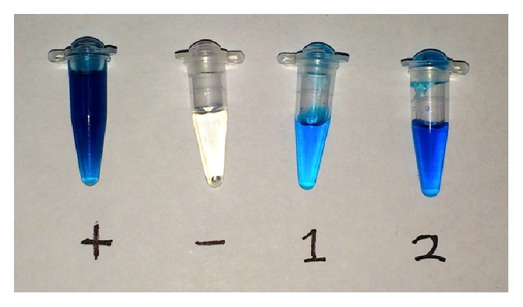 Selection of DNA Aptamers for Ovarian Cancer Biomarker CA125 Using One-Pot SELEX and High-Throughput Sequencing.