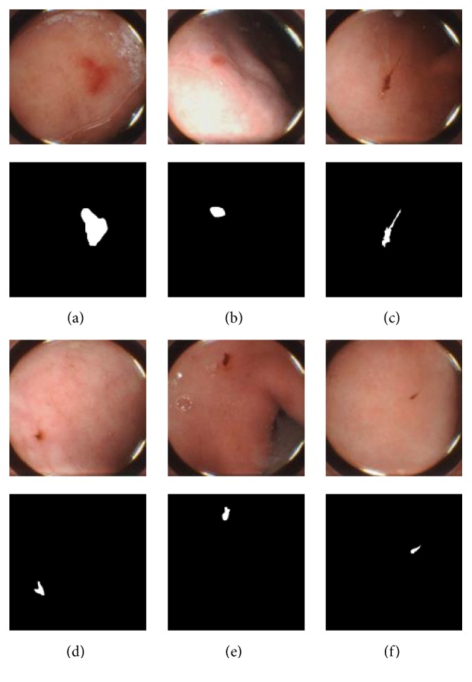 Saliency-Based Bleeding Localization for Wireless Capsule Endoscopy Diagnosis.