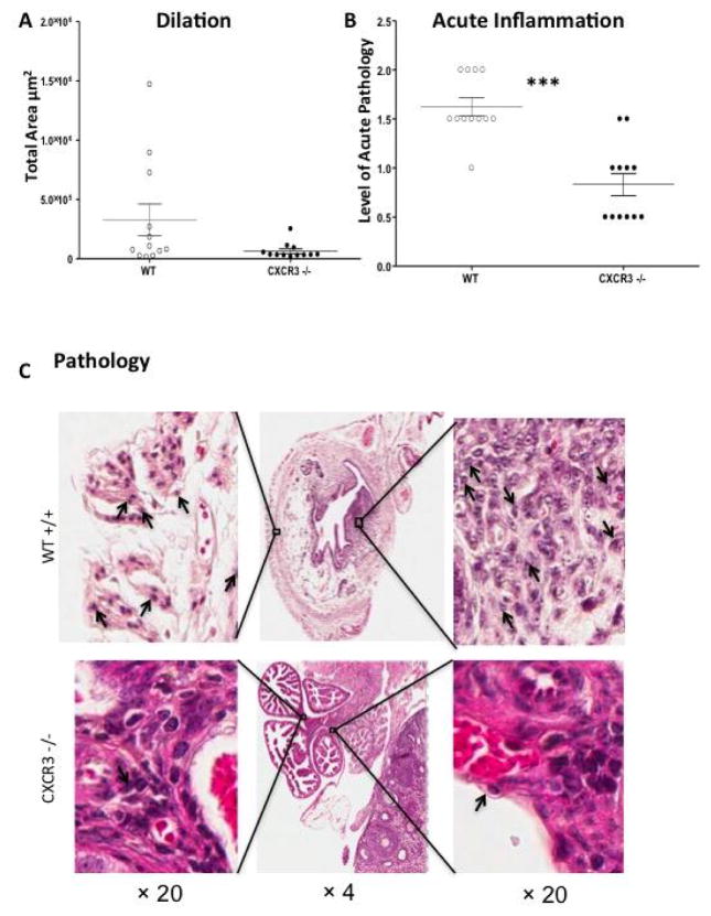 Expression of CXCR3 on Adaptive and Innate Immune Cells Contributes Oviduct Pathology throughout <i>Chlamydia muridarum</i> Infection.