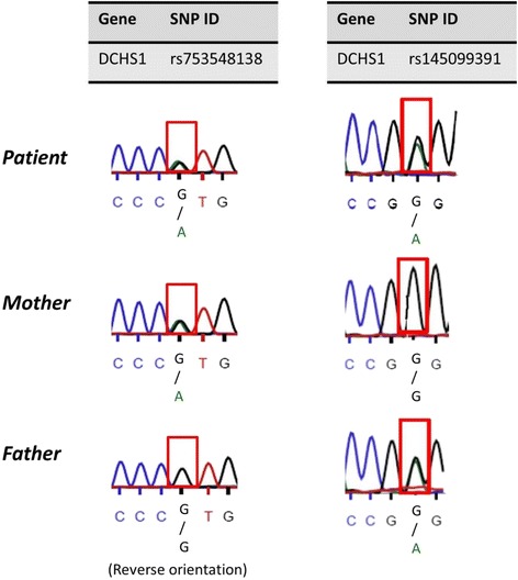 A patient with van Maldergem syndrome with endocrine abnormalities, hypogonadotropic hypogonadism, and breast aplasia/hypoplasia.