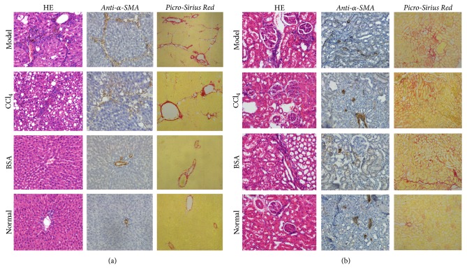 An Attempt to Establish a Common Animal Model for Hepatorenal Fibrosis in Rats.