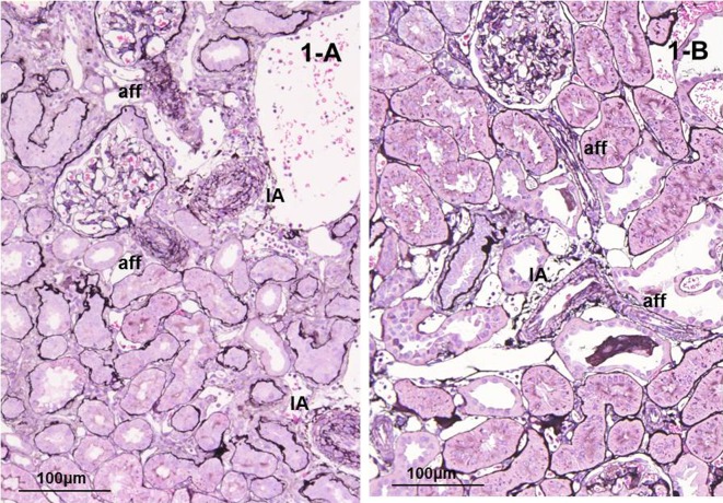 Changes in renal vessels associated with long-term administration of angiotensin converting enzyme inhibitor in Zucker fatty rats.