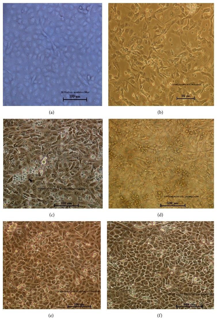 Adaptation and Molecular Characterization of Two Malaysian Very Virulent Infectious Bursal Disease Virus Isolates Adapted in BGM-70 Cell Line.