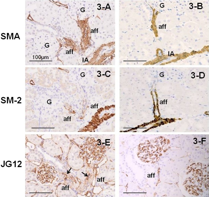 Changes in renal vessels associated with long-term administration of angiotensin converting enzyme inhibitor in Zucker fatty rats.