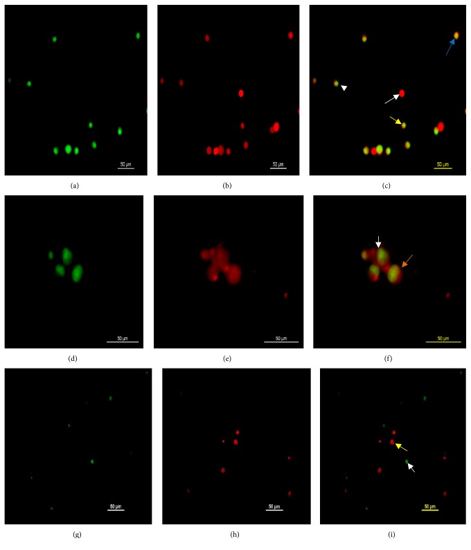 Adaptation and Molecular Characterization of Two Malaysian Very Virulent Infectious Bursal Disease Virus Isolates Adapted in BGM-70 Cell Line.