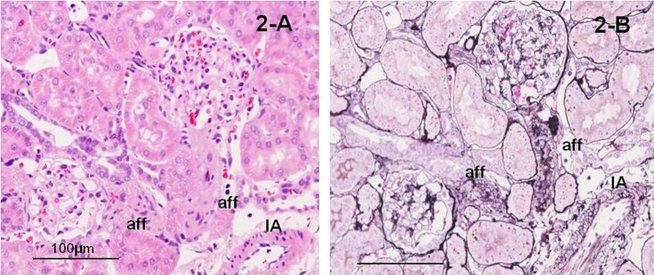 Changes in renal vessels associated with long-term administration of angiotensin converting enzyme inhibitor in Zucker fatty rats.