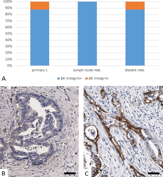 Perspective of αvβ6-Integrin Imaging for Clinical Management of Pancreatic Carcinoma and Its Precursor Lesions.