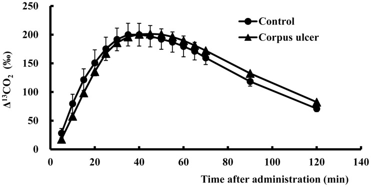 Gastric emptying after artificial ulceration in rats: differences due to the site of the ulcer and the effects of prokinetic drugs.