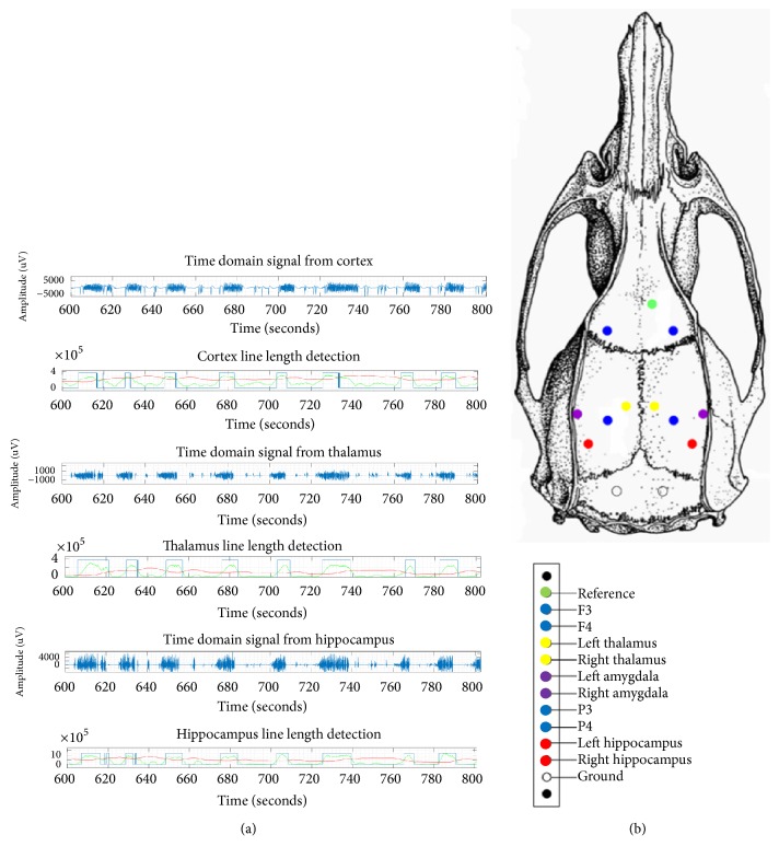 Seizure Detection and Network Dynamics of Generalized Convulsive Seizures: Towards Rational Designing of Closed-Loop Neuromodulation.