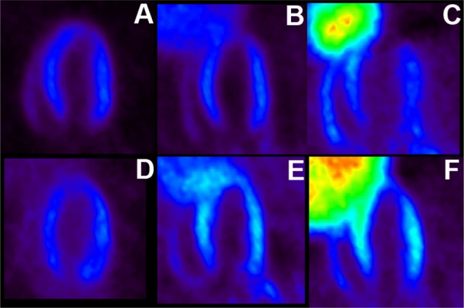 Longitudinal Evaluation of Myocardial Fatty Acid and Glucose Metabolism in Fasted and Nonfasted Spontaneously Hypertensive Rats Using MicroPET/CT.