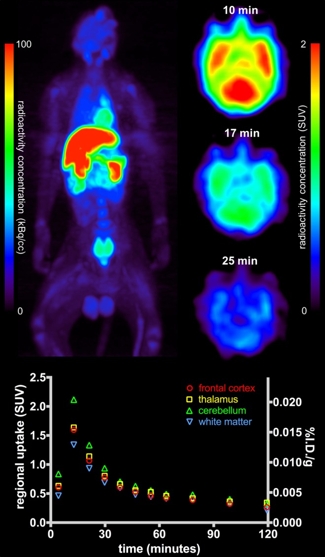 Brain Penetration of the ROS1/ALK Inhibitor Lorlatinib Confirmed by PET.