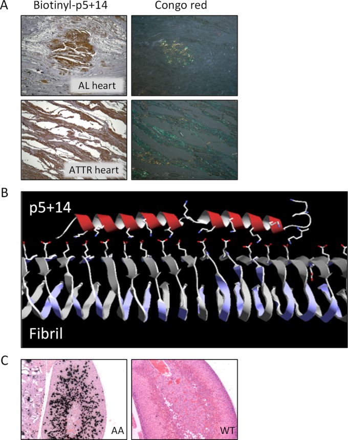 Dual-Energy SPECT and the Development of Peptide p5+14 for Imaging Amyloidosis.