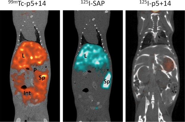 Dual-Energy SPECT and the Development of Peptide p5+14 for Imaging Amyloidosis.