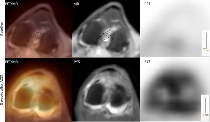 Preclinical Multimodal Molecular Imaging Using <sup>18</sup>F-FDG PET/CT and MRI in a Phase I Study of a Knee Osteoarthritis in In Vivo Canine Model.