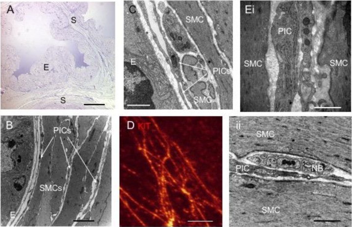 Role of prostatic interstitial cells in prostate motility.