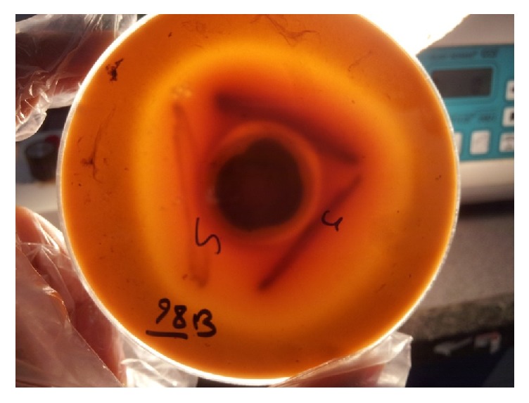 Evaluation of CAMP-Like Effect, Biofilm Formation, and Discrimination of <i>Candida africana</i> from Vaginal <i>Candida albicans</i> Species.