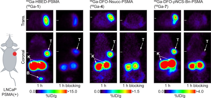 Radiochemistry and Preclinical PET Imaging of <sup>68</sup>Ga-Desferrioxamine Radiotracers Targeting Prostate-Specific Membrane Antigen.