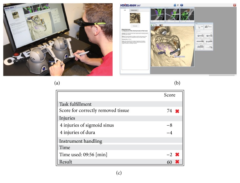 Construct, Face, and Content Validation on Voxel-Man® Simulator for Otologic Surgical Training.