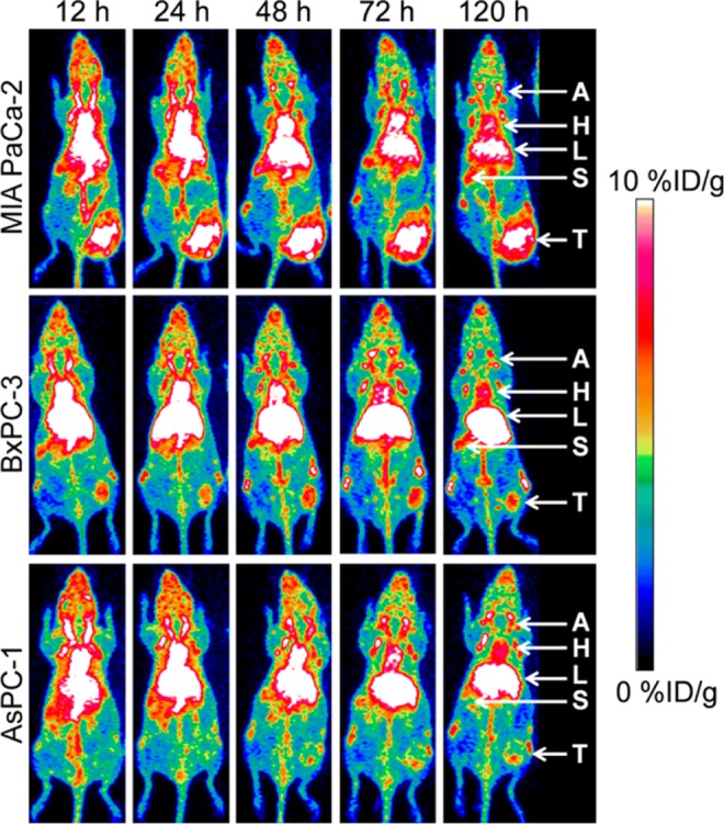 Molecular Imaging of IGF-1R in Cancer.