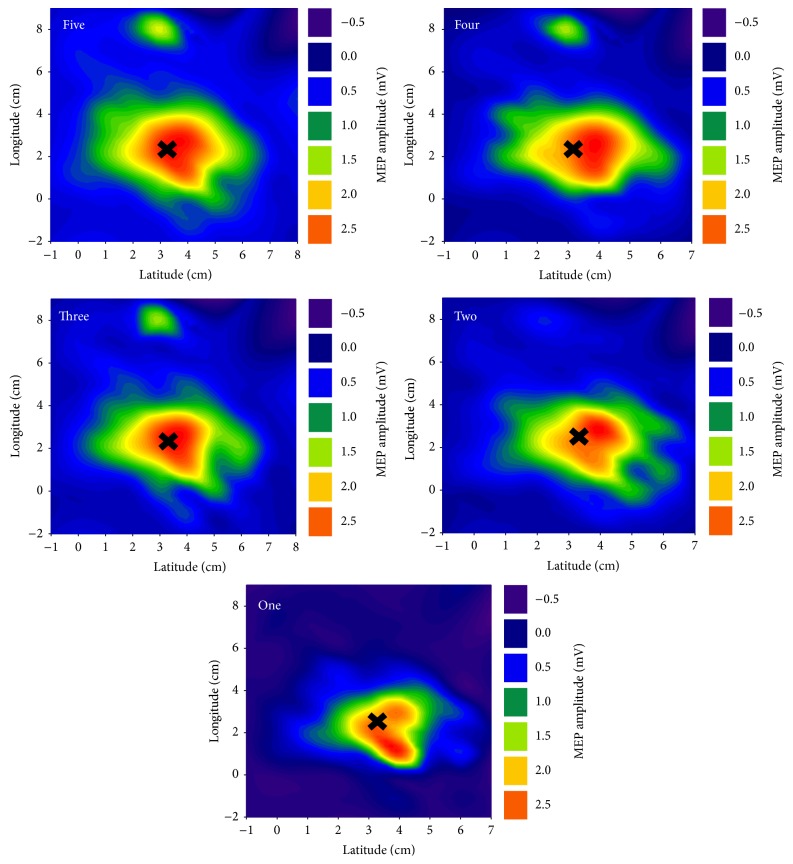 Determining the Optimal Number of Stimuli per Cranial Site during Transcranial Magnetic Stimulation Mapping.