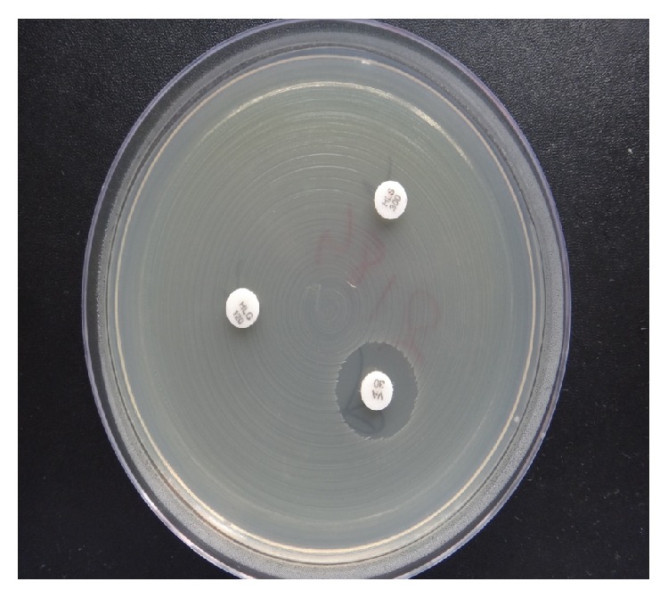 Analysis of Aminoglycoside Modifying Enzyme Genes Responsible for High-Level Aminoglycoside Resistance among Enterococcal Isolates.