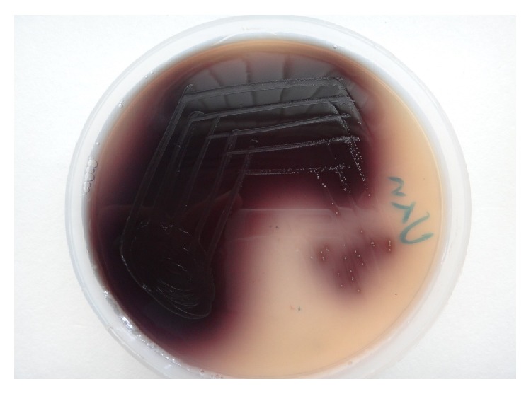 Analysis of Aminoglycoside Modifying Enzyme Genes Responsible for High-Level Aminoglycoside Resistance among Enterococcal Isolates.