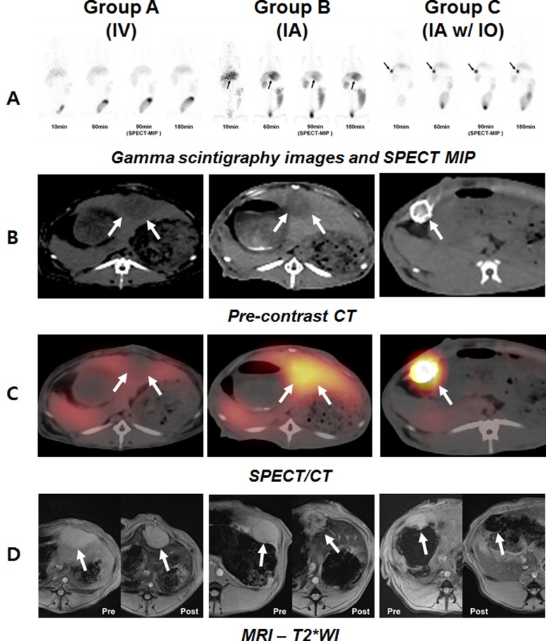 Image-Based Analysis of Tumor Localization After Intra-Arterial Delivery of Technetium-99m-Labeled SPIO Using SPECT/CT and MRI.