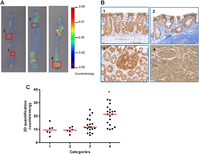 Ex Vivo and In Vivo Noninvasive Imaging of Epidermal Growth Factor Receptor Inhibition on Colon Tumorigenesis Using Activatable Near-Infrared Fluorescent Probes.