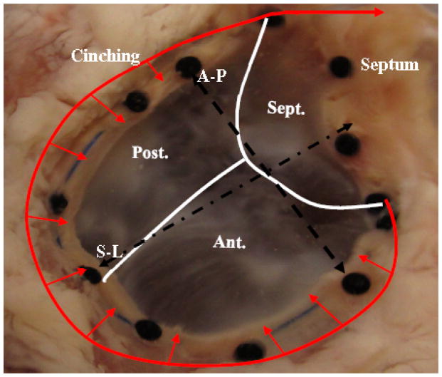 Effects of Cinching Force on the Tricuspid Annulus: A Species Comparison.