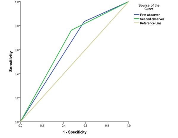 Diagnostic accuracy of cone-beam computed tomography in detecting secondary caries under composite fillings: an in vitro study.