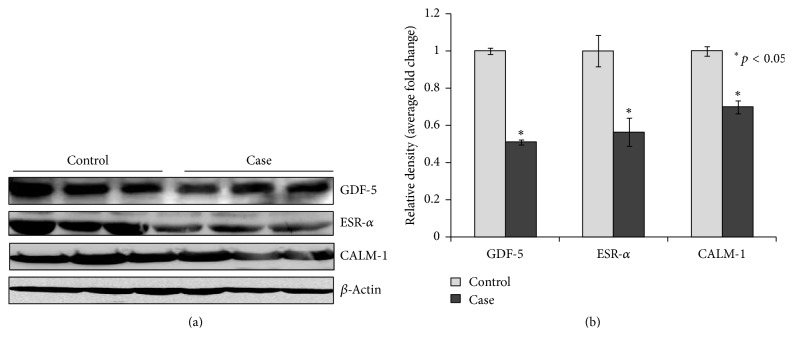 Expression of Genes and Their Polymorphism Influences the Risk of Knee Osteoarthritis.